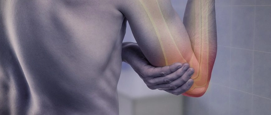 Dolor en el codo: ¿Qué es la epicondilitis y cómo curarla?